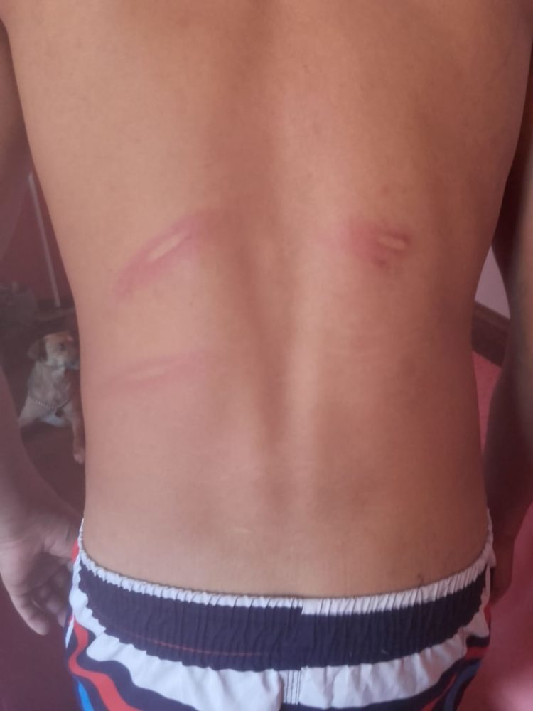 Policía sin cuarentena y la brutal golpiza a un joven de 22 años: “Me decían que tenían una bala para mí”